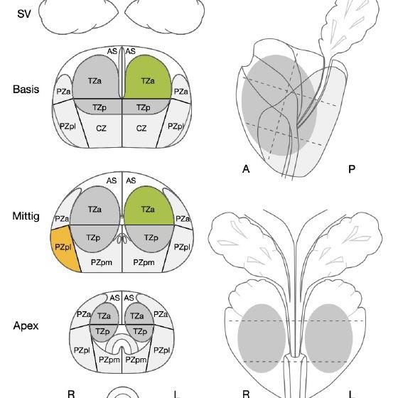 mpMRT der Prostata PIRADS Auswertung